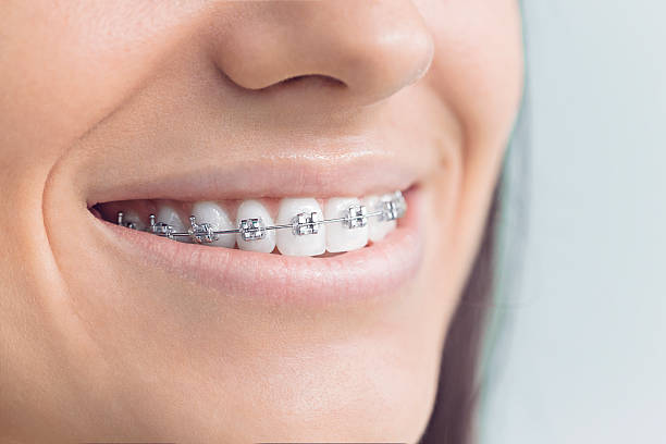 Best Teeth Whitening  in Spring Valley, IL